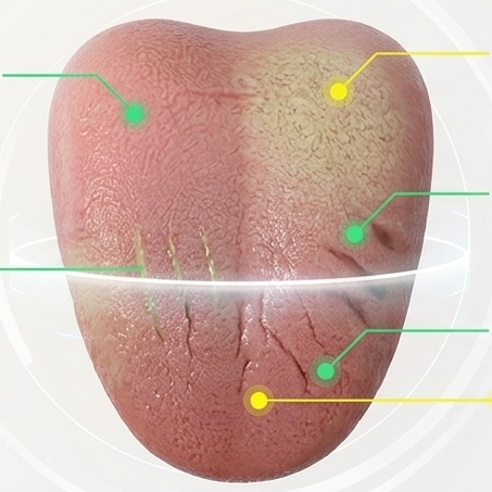 舌象识别功能演示